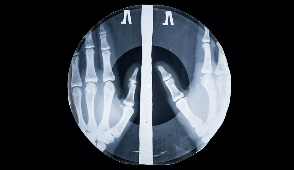 Illustration pour La « Bone music », ou quand les Russes écoutaient de la musique sur des radios pour éviter la censure