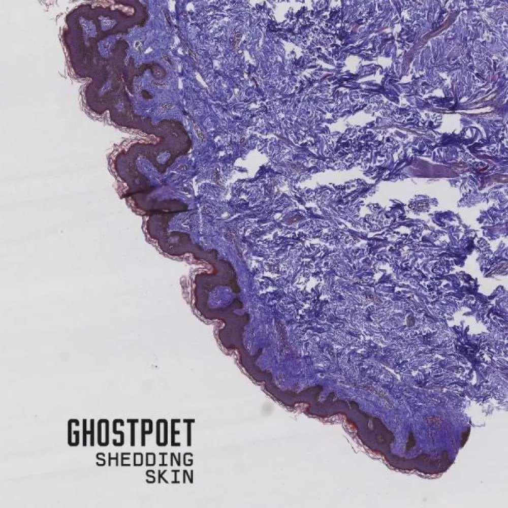 Illustration pour Chronique et écoute&nbsp;: Ghostpoet &#8211; Shedding Skin