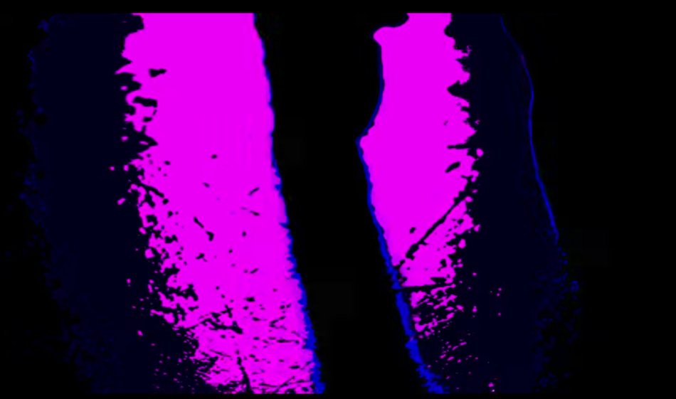 Illustration pour Tsugi Daily&nbsp;: un clip d&rsquo;Avey Tare (Animal Collective), un rapport accablant la police nantaise…