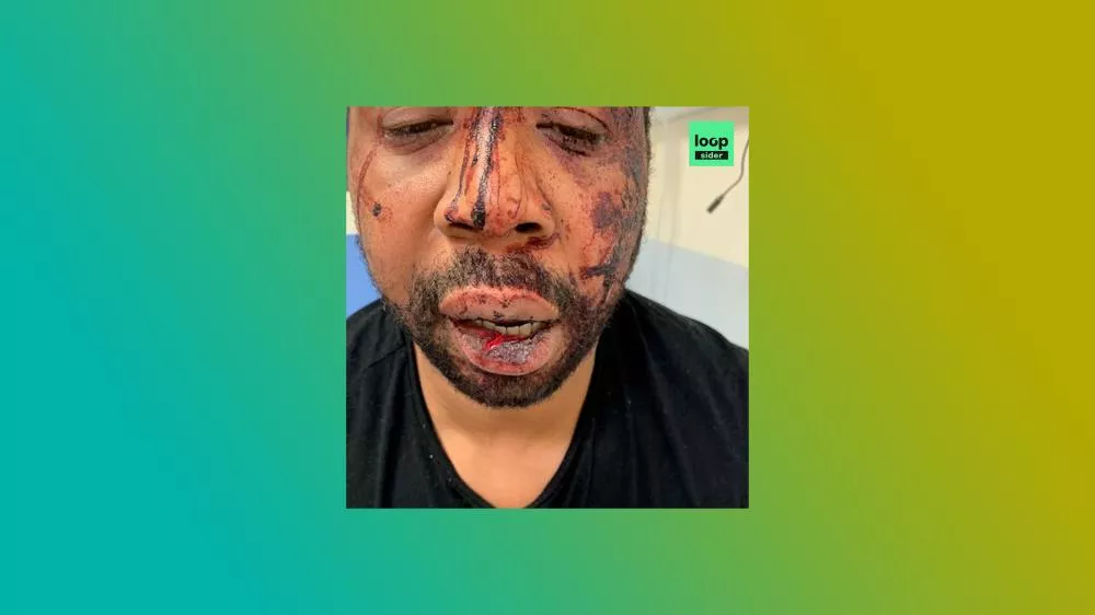 Illustration pour Un producteur de musique a été roué de coups par 3 policiers dans son studio