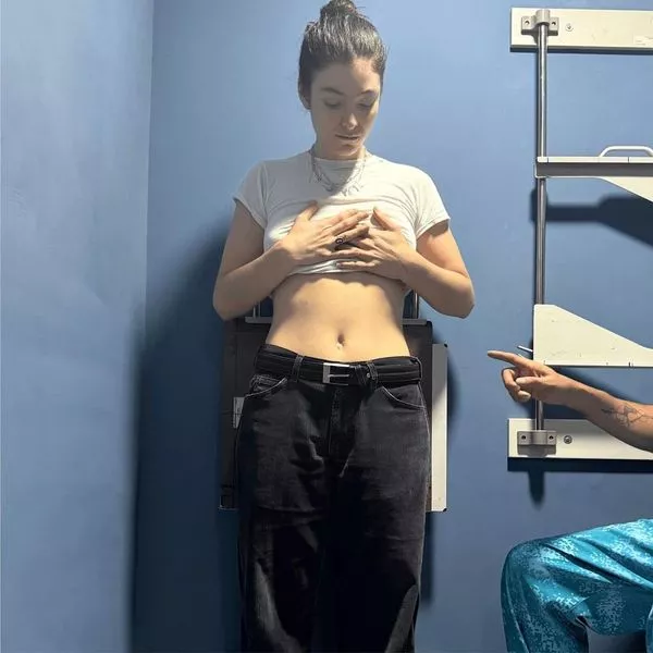 La cover de X-Rays © Lorde